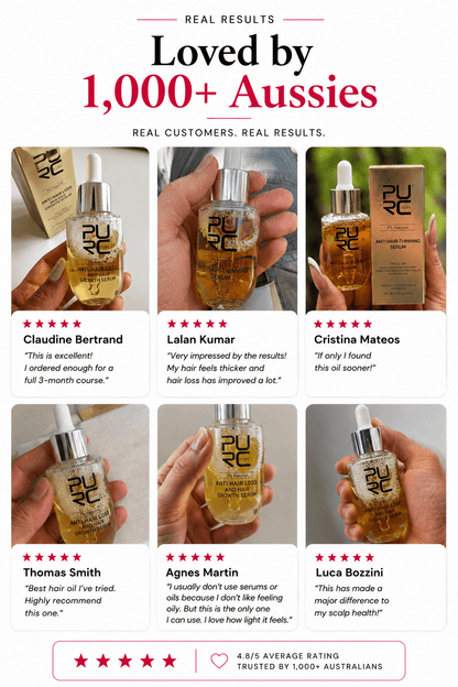 SelfCareCo™️ Scalp Repair Oil